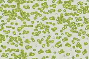 Ковролин Flotex Sottsass Bacteria 990203 фото  | FLOORDEALER