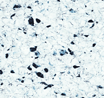 Линолеум Polyflor Finesse Ec 5360 фото 1 | FLOORDEALER