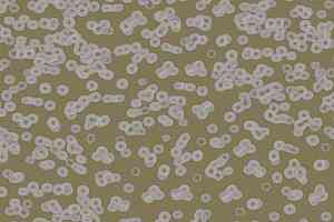 Ковролин Flotex Sottsass Bacteria 990401 фото  | FLOORDEALER