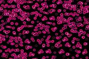 Ковролин Flotex Sottsass Bacteria 990101 фото  | FLOORDEALER