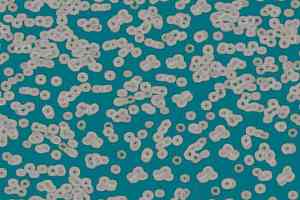 Ковролин Flotex Sottsass Bacteria 990404 фото  | FLOORDEALER