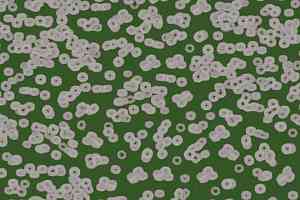 Ковролин Flotex Sottsass Bacteria 990403 фото  | FLOORDEALER