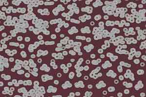 Ковролин Flotex Sottsass Bacteria 990402 фото  | FLOORDEALER