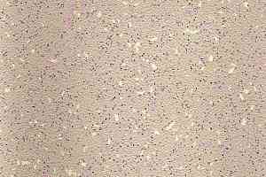 Линолеум Stop F 2.5 2278-990-05-263 фото  | FLOORDEALER