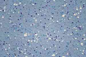 Линолеум Tarasafe Ultra H2O 7413_Ocean_Blue фото  | FLOORDEALER