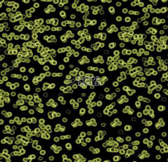 Ковролин Flotex Sottsass Bacteria 990103 фото 1 | FLOORDEALER