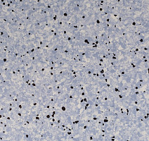 Линолеум Standard Conductive 804 Lake фото 1 | FLOORDEALER